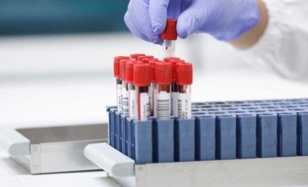 6130 нови случая на COVID-19 у нас